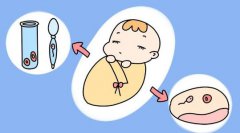 淮北助孕中心供卵生孩子哪家机构靠谱？