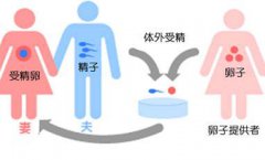 北京东城区同性生子需要多少钱？